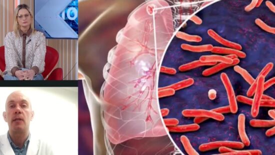 Preocupa el aumento de casos de tuberculosis en la Argentina 3 ok